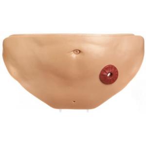 CLA 411 Abdominal cavity cover with colostomy
