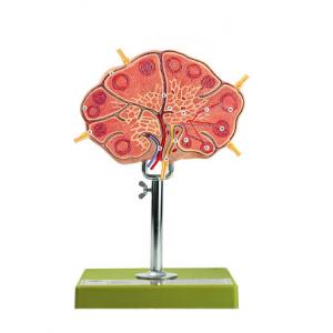 Ganglion lymphatique / SUR DEMANDE Non démontable. Sur support avec socle.