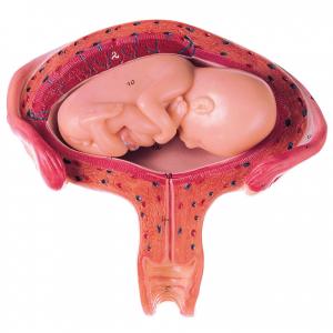 Utérus avec foetus dans le 4. - 5. mois