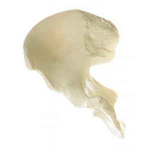 Pelle pelvienne L'aile iliaque (Os coxae), Moulage naturel